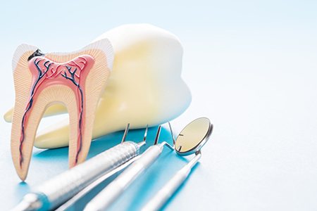 The image shows a side-by-side comparison of two dental models with toothbrushes placed on them, highlighting the differences between a healthy tooth structure and one that requires dental work, such as a cavity or gum disease.